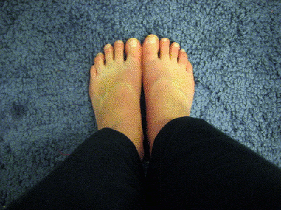 Winter Feet - Razblint 2